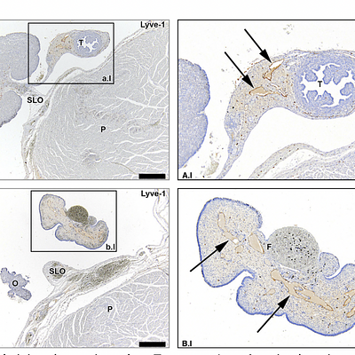Lymph vessels draining the uterine tubes. Transverse Lyve-1Ystained sections of the fetus aged 15 weeks showing that lymph vessels draining the uterine tubes (arrows) run in the mesosalpinx. Note the substantial amount of lymph vessels along the entire length of the uterine tubes until its fimbriae (F). O indicates ovary; T, uterine tube; P, psoas major muscle. Scale bar overview, 500 Km; scale bar detail, 200 Km.