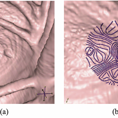 (a) A polyp with its surrounding environment. (b) Example of the curvature streamlines generated in the vicinity of the polyp.