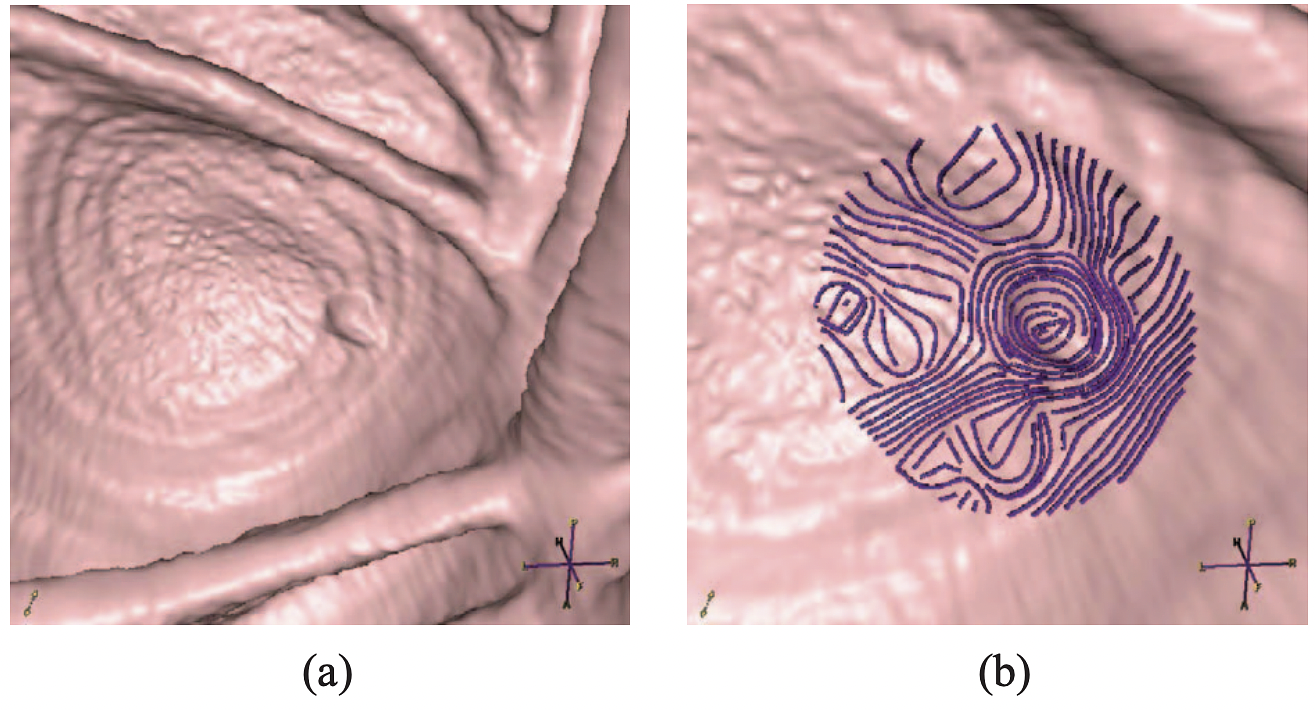 (a) A polyp with its surrounding environment. (b) Example of the curvature streamlines generated in the vicinity of the polyp.