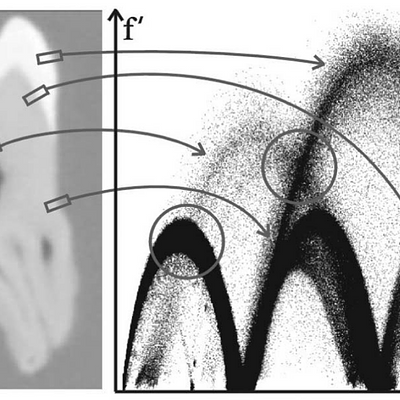 CT data set of a tooth with corresponding arches