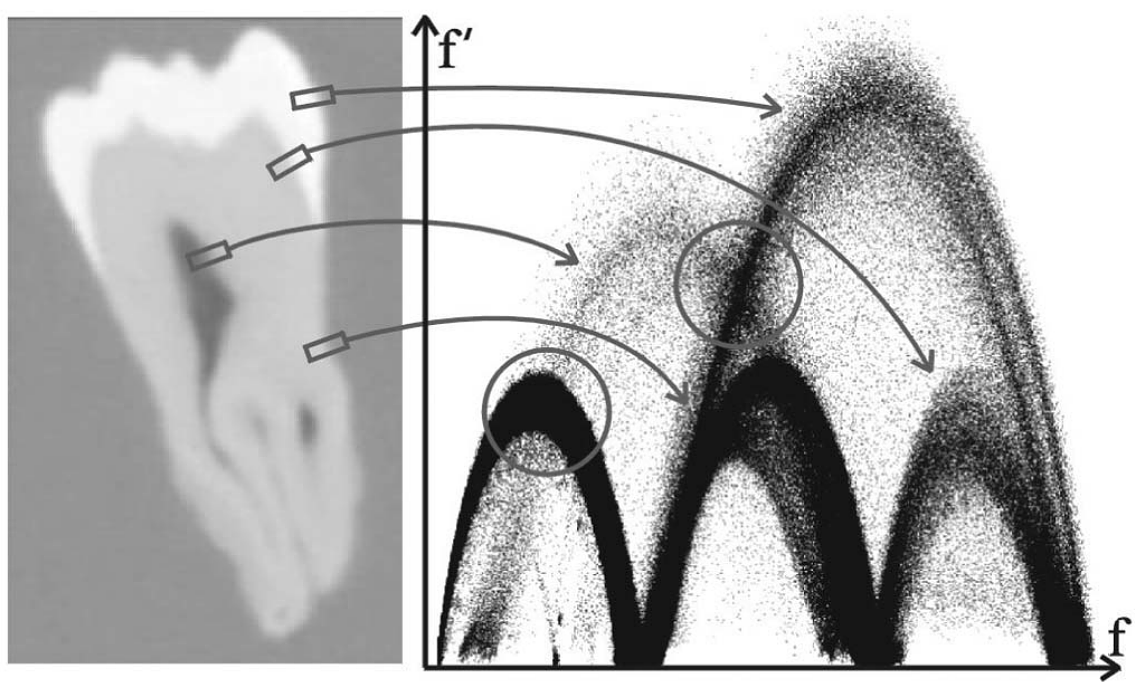 CT data set of a tooth with corresponding arches