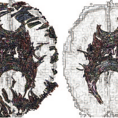 Fiber-tracking image