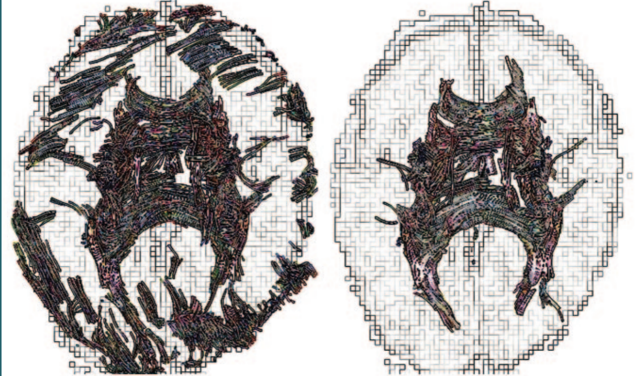 Fiber-tracking image