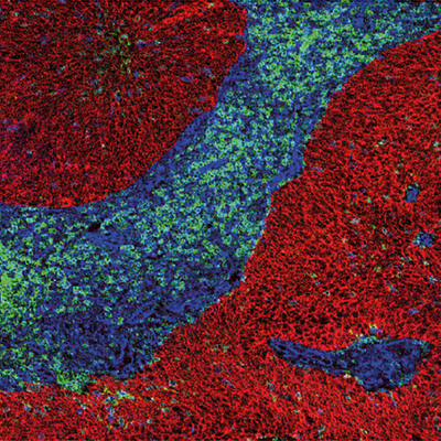HPV16+ tissue image