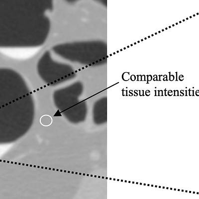 Intensity values on a boundary can be similar to single material intensities through convolving with the PSF. 