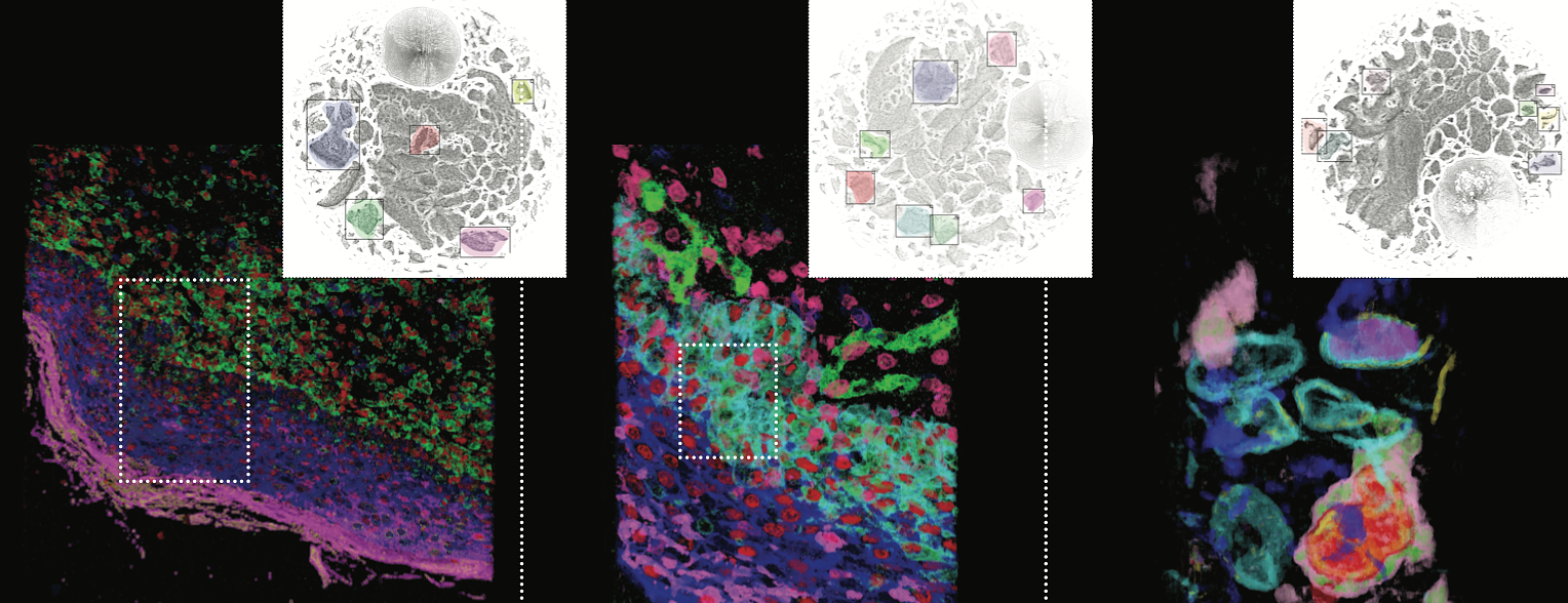 Volume rendering of three different ROIs from the challenge dataset