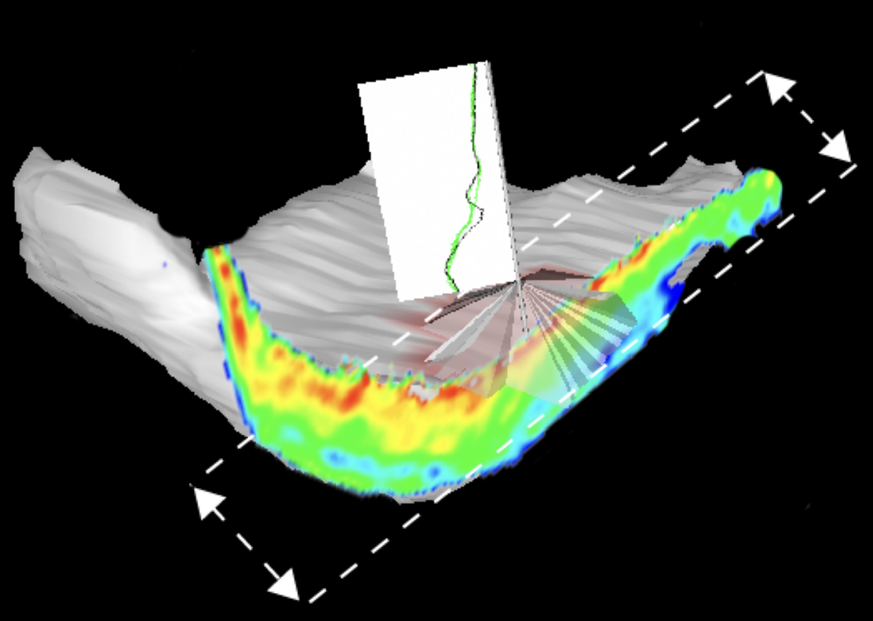 The cutting plane can be moved along its normal within the range of selected locations.